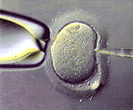 ICSI.gif image by Demeter1966